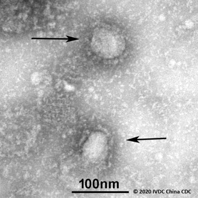 출처= Global Initiative on Sharing All Influenza Data (GISAID)